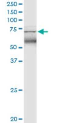 Western Blot: TRIM47 Antibody (3C8) [H00091107-M02]