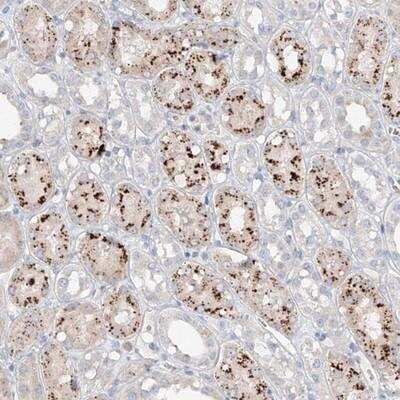 Immunohistochemistry-Paraffin: TRIM47 Antibody [NBP1-83353]