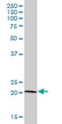 Western Blot: TRIM48 Antibody [H00079097-B01P]