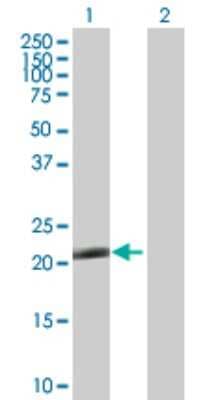 Western Blot: TRIM48 Antibody [H00079097-B01P]