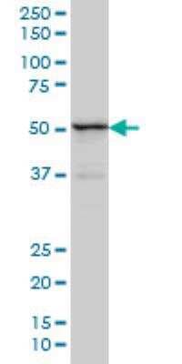 Western Blot: TRIM49 Antibody (2E5) [H00057093-M01]