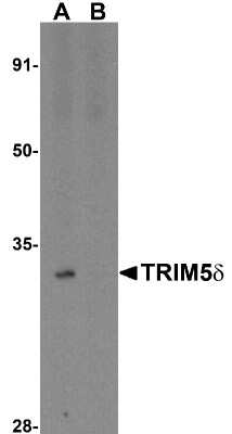 Western Blot: TRIM5 delta AntibodyBSA Free [NBP1-76603]