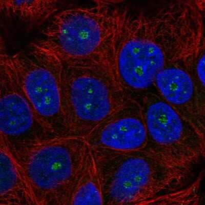 Immunocytochemistry/ Immunofluorescence: TRIM52 Antibody [NBP2-56725]