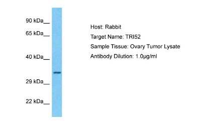 Western Blot: TRIM52 Antibody [NBP2-88476]