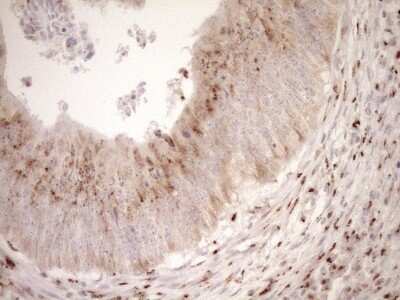 Immunohistochemistry: TRIM56 Antibody (OTI5A1) [NBP2-46232]