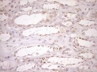 Immunohistochemistry: TRIM56 Antibody (OTI5A1) [NBP2-46232]