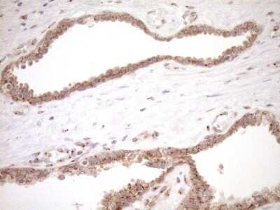 Immunohistochemistry: TRIM56 Antibody (OTI5A1) [NBP2-46232]