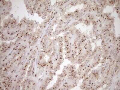 Immunohistochemistry: TRIM56 Antibody (OTI5A1) - Azide and BSA Free [NBP2-74613]