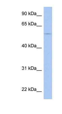 Western Blot: TRIM58 Antibody [NBP1-79706]