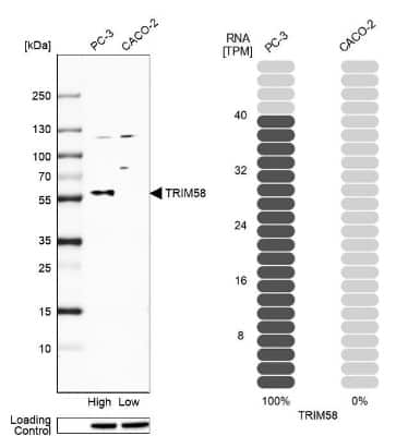 Western Blot: TRIM58 Antibody [NBP1-88608]