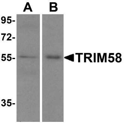 Western Blot: TRIM58 AntibodyBSA Free [NBP2-81870]