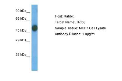 Western Blot: TRIM58 Antibody [NBP2-88477]