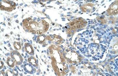 Immunohistochemistry-Paraffin: TRIM59 Antibody [NBP1-59777]