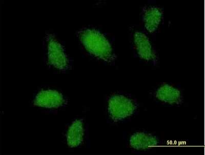 Immunocytochemistry/ Immunofluorescence: TRIM62 Antibody [H00055223-B01P]