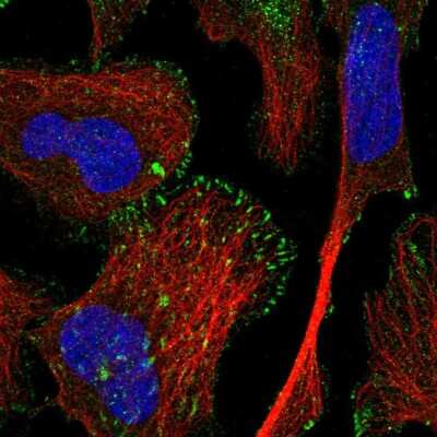 Immunocytochemistry/ Immunofluorescence: TRIM62 Antibody [NBP2-55505]