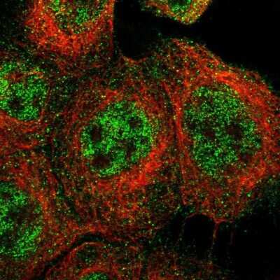Immunocytochemistry/ Immunofluorescence: TRIM65 Antibody [NBP1-86017]