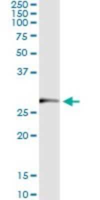 Immunoprecipitation: TRIM72 Antibody (3B5) [H00493829-M05]