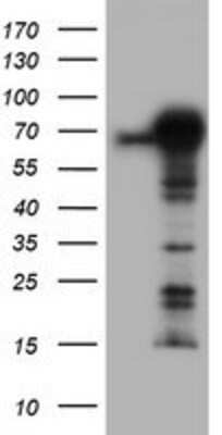 Western Blot: TRIM9 Antibody (OTI2D6) [NBP2-03794]