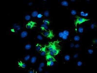 Immunocytochemistry/ Immunofluorescence: TRIM9 Antibody (OTI2D6) - Azide and BSA Free [NBP2-74616]