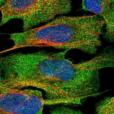 Immunocytochemistry/ Immunofluorescence: TRIML2 Antibody [NBP1-92531]