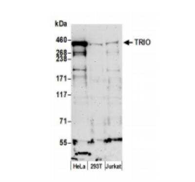 Western Blot: TRIO Antibody [NBP2-32088]