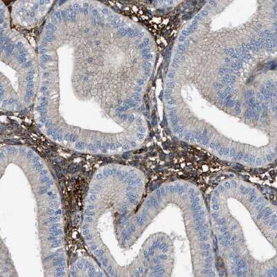 Immunohistochemistry-Paraffin: TRIOBP Antibody [NBP1-90589]