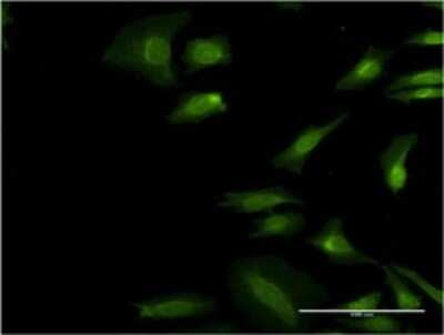 Immunocytochemistry/ Immunofluorescence: TRIP1 Antibody (3B10) [H00008668-M01]