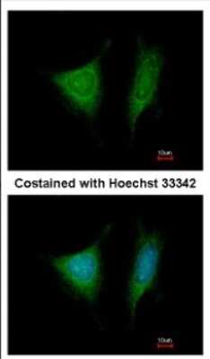 Immunocytochemistry/ Immunofluorescence: TRIP1 Antibody [NBP2-16300]
