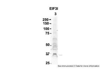 Western Blot: TRIP1 Antibody [NBP1-98293]
