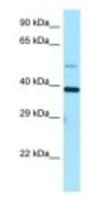 Western Blot: TRIP1 Antibody [NBP1-98293]
