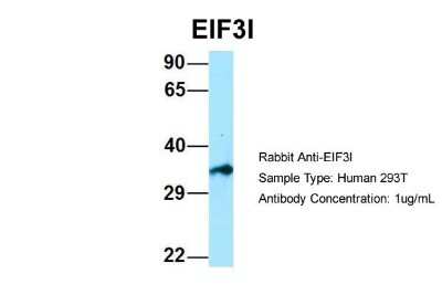 Western Blot: TRIP1 Antibody [NBP1-98293]