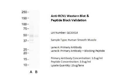 Western Blot: TRIP1 Antibody [NBP1-98293]