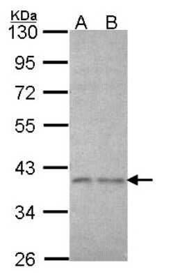 Western Blot: TRIP1 Antibody [NBP2-16300]