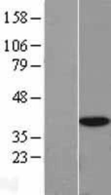 Western Blot: TRIP1 Overexpression Lysate [NBL1-10197]