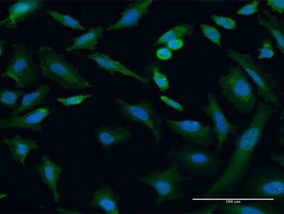 Immunocytochemistry/ Immunofluorescence: TRIP6 Antibody (3D12) [H00007205-M07]