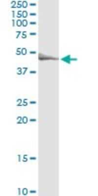 Immunoprecipitation: TRIP6 Antibody (3D12) [H00007205-M07]