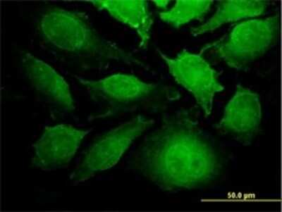 Immunocytochemistry/ Immunofluorescence: TRIP6 Antibody (4B7) [H00007205-M04]
