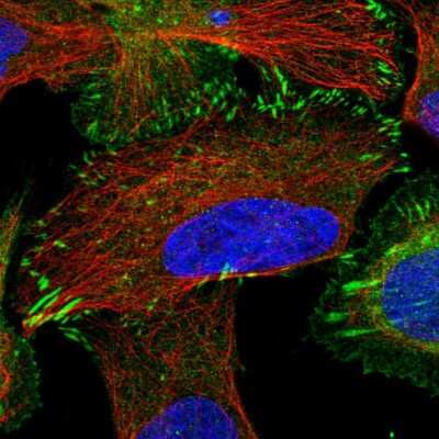 Immunocytochemistry/ Immunofluorescence: TRIP6 Antibody [NBP2-33667]