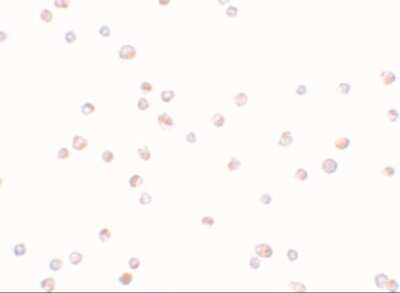 Immunocytochemistry/ Immunofluorescence: TRIP6 Antibody - BSA Free [NBP1-76305]