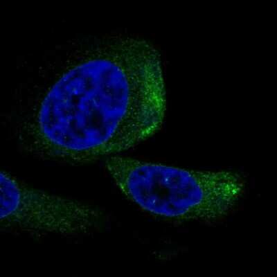 Immunocytochemistry/ Immunofluorescence: TRIQK Antibody [NBP2-69026]