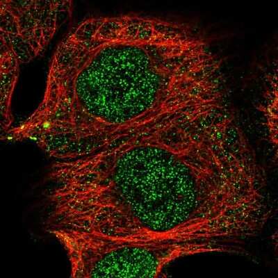 Immunocytochemistry/ Immunofluorescence: TRIT1 Antibody [NBP1-82210]