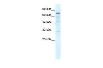 Western Blot: TRM1 Antibody [NBP2-86002]