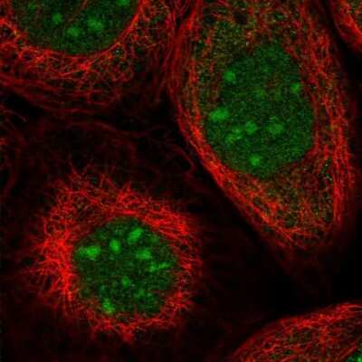 Immunocytochemistry/ Immunofluorescence: TRMT1L Antibody [NBP1-88337]