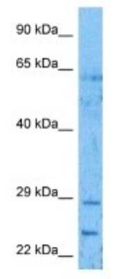 Western Blot: TRNP1 Antibody [NBP3-09899]