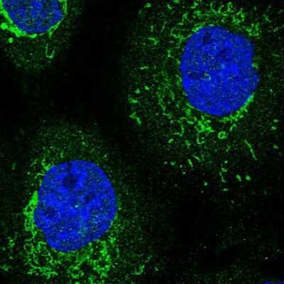 Immunocytochemistry/ Immunofluorescence: TRNT1 Antibody [NBP1-86589]