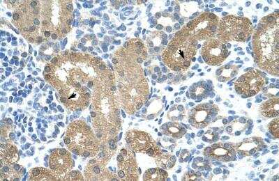 Immunohistochemistry-Paraffin: TRNT1 Antibody [NBP1-57224]