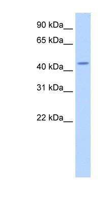 Western Blot: TRNT1 Antibody [NBP1-57224]