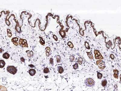Immunohistochemistry-Paraffin: TROP-2 Antibody (046) [NBP2-90742]