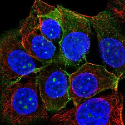 Immunocytochemistry/ Immunofluorescence: TROP-2 Antibody [NBP2-49166]