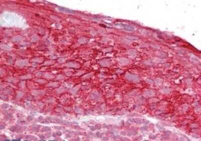 Immunohistochemistry-Paraffin: TROP-2 Antibody [NBP1-05036]